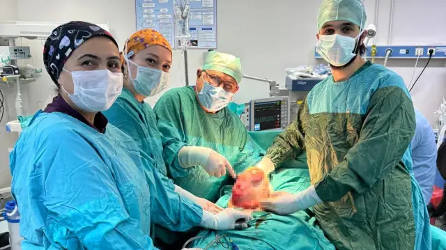 Patoloji laboratuvarında kitle örneği