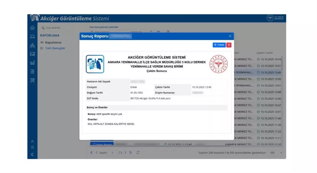 e-Nabız Üzerinden Akciğer Görüntüleme Sistemi Kullanıma Açıldı