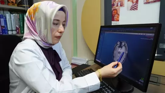 Epilepsi nöbeti anı