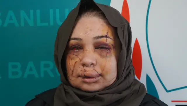 Kadının yaşadığı yaralanma