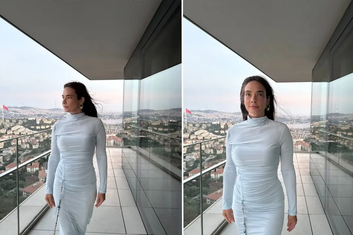 Müge Boz, 20 Yıldır Sedef Hastalığıyla Mücadele Ediyor: Detoks Sürecinde Açıklıyor