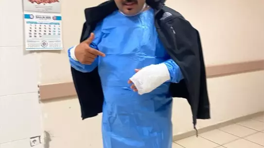 Sivas’ta Sıcak Su Deneyi Sırasında Esnaf Yaralandı