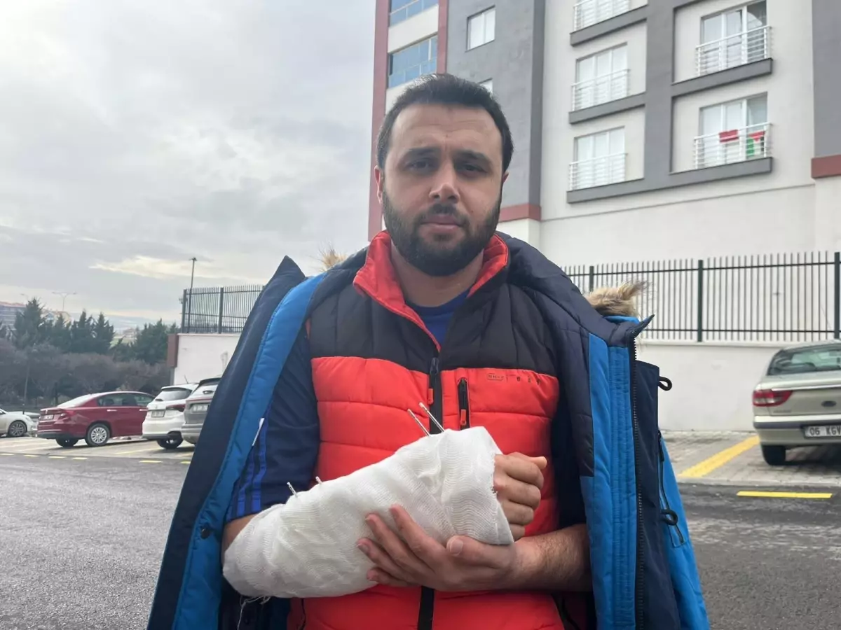 Ankara’da Sokak Köpekleri Saldırısı Sonucu Bir Vatandaşa Kol Kırıldı