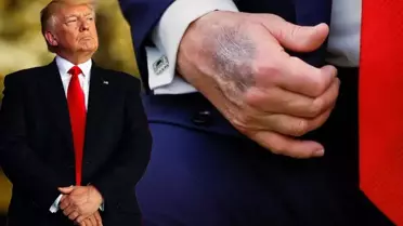 Trump'ın morarmış eli yakın çekim