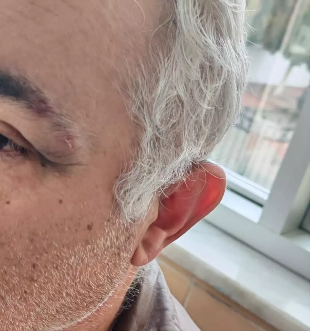 Konya’da Müezzin ve Aile Hekimi Arasındaki Muayene Sırası Tartışması