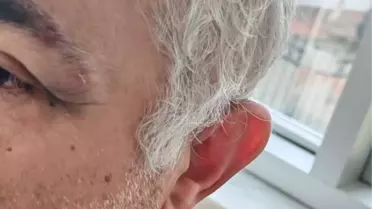 Konya’da Müezzin ve Aile Hekimi Arasındaki Muayene Sırası Tartışması