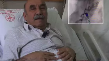 Koroner arter fistülünün anjiyografi görüntüsü