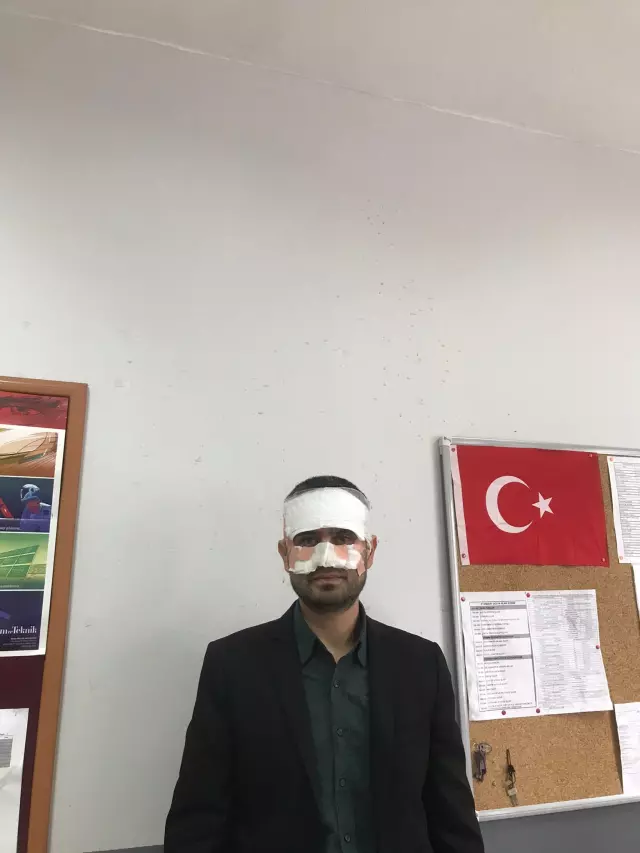Fizik öğretmeninin yaralanma durumu
