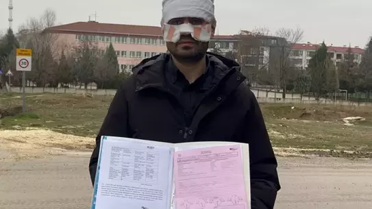 Eskişehir Lisesinde Rehber Öğretmenin Sıcak Çay Saldırısı: Fizik Öğretmeni Şoke Oldu