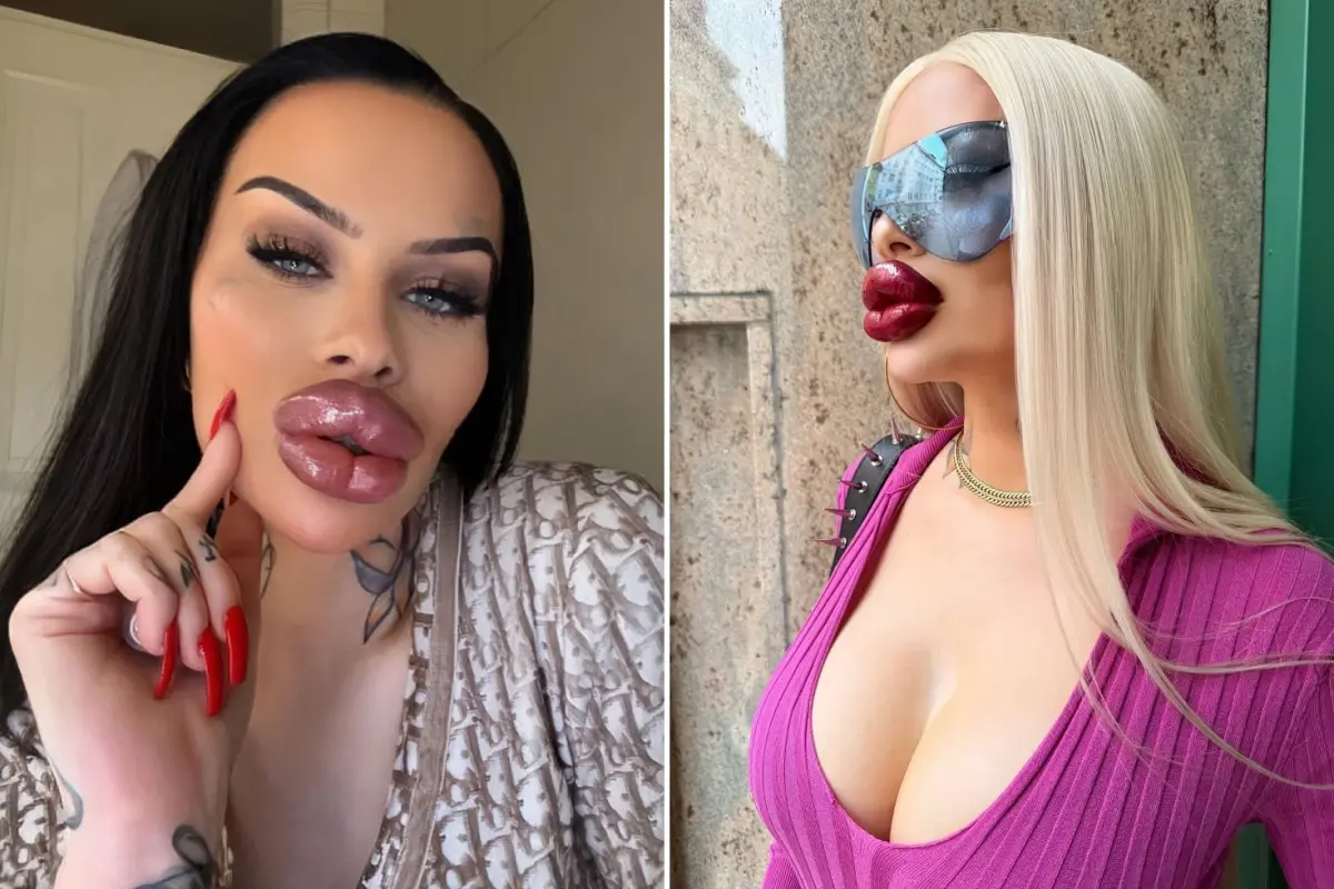 Fetisch Barbie'nin 68 Bin Dolarlık Estetik Harcamaları: Dolgu ve Botoks Bağımlılığı