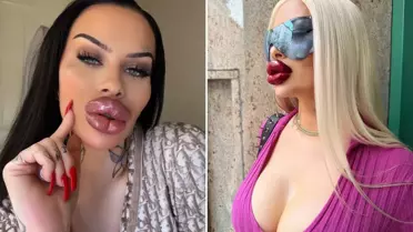 Fetisch Barbie'nin estetik öncesi ve sonrası