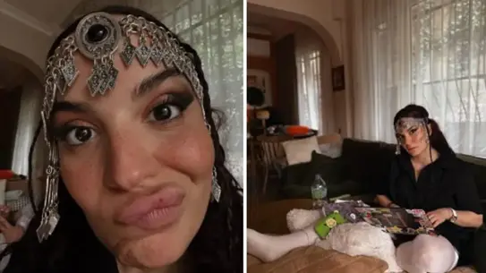 Aslı Bekiroğlu, Bağırsağının Yanlışlıkla Kesilmesinin Ardından 5. Ameliyatını Tamamladı ve Durumunu Paylaştı